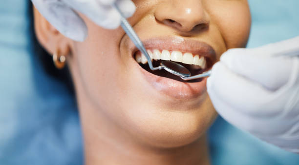 Best Emergency Dental Care for Broken or Chipped Teeth in Siesta Shores, TX